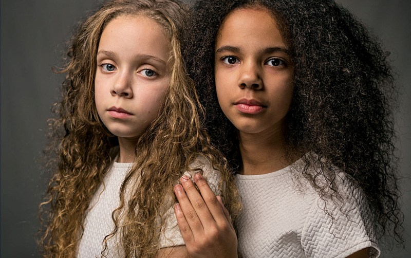 Τα δίδυμα κορίτσια που "προκαλούν" την επιστήμη