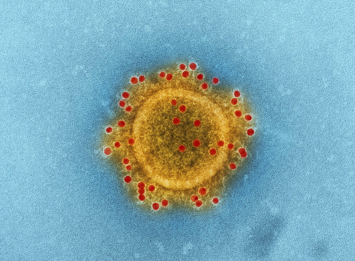 Κοροναϊος | Νέα κρούσματα - Έφτασαν τα 45 συνολικά