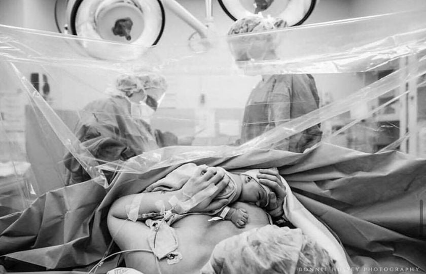 Η επαφή δέρμα με δέρμα αμέσως μετά την γέννηση του μωρού μειώνει την αίσθηση του πόνου της μητέρας