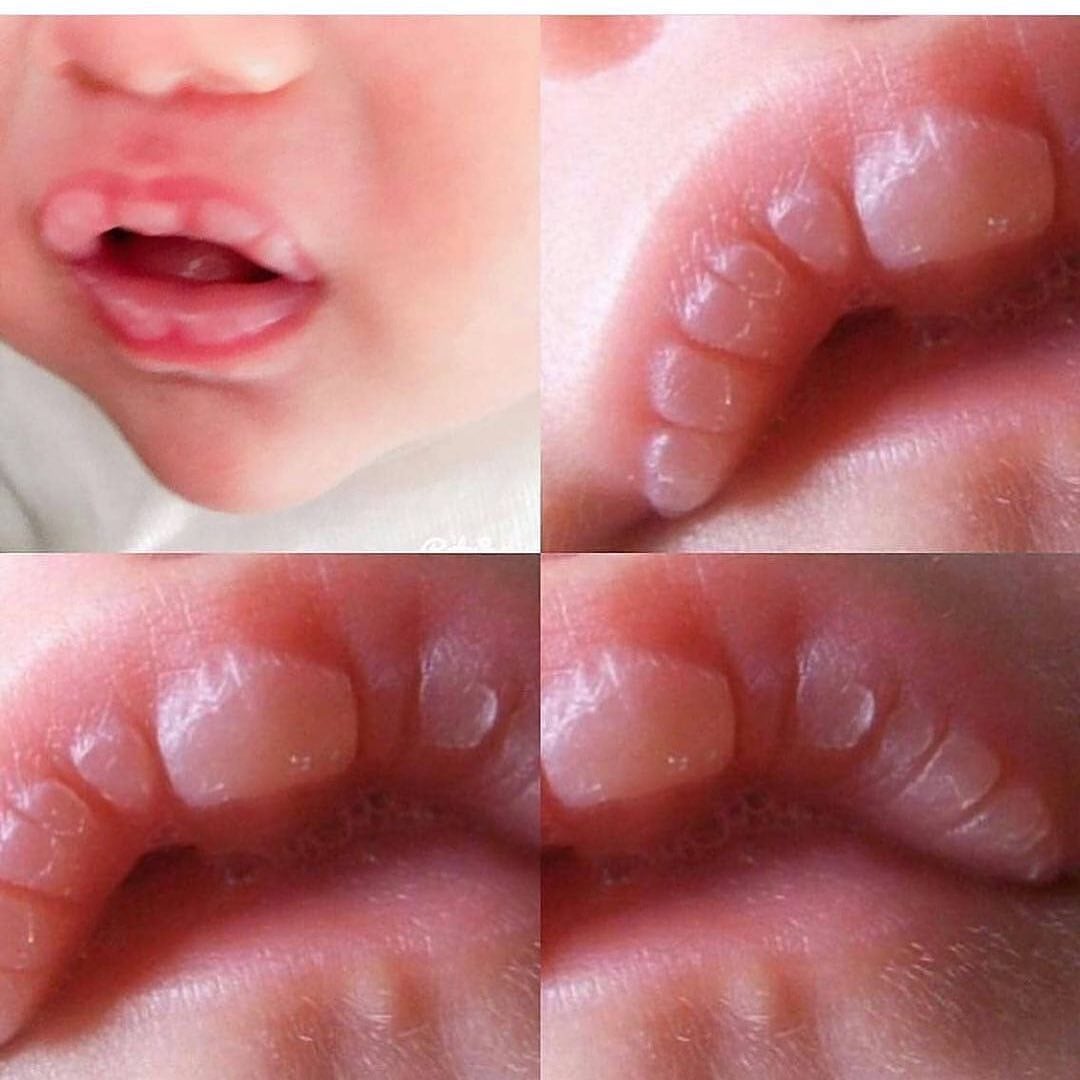 Έχετε δει ποτέ αυτά τα λευκά σημάδια στα χείλη του μωρού σας μετά από τον θηλασμό;