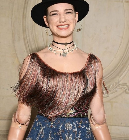 «Κόσμε, είμαι μία τυχερή γυναίκα. Τα πηγαίνω μια χαρά με τα προσθετικά μου πόδια και χέρια»