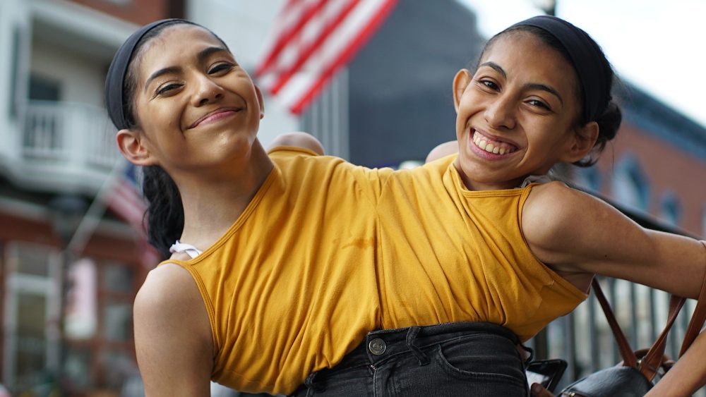 Σιαμαίες 21 ετών, μιλούν για την κοινή τους ζωή: «Είναι αναπηρία μόνο αν την ζήσεις ως αναπηρία»