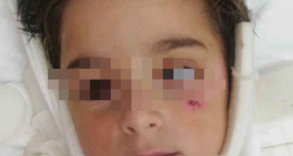 Κρήτη: Τα κατάφερε ο μικρός Γιώργος που τον χτύπησε 10 φορές το κριάρι!