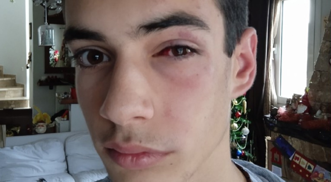 "Απομονώστε τις οικογένειες που μεγαλώνουν "μάγκες" και νταήδες"