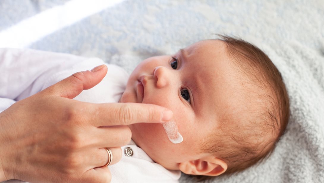 Ατοπική δερματίτιδα: 8 tips για να φροντίσεις την επιδερμίδα του μωρού σου