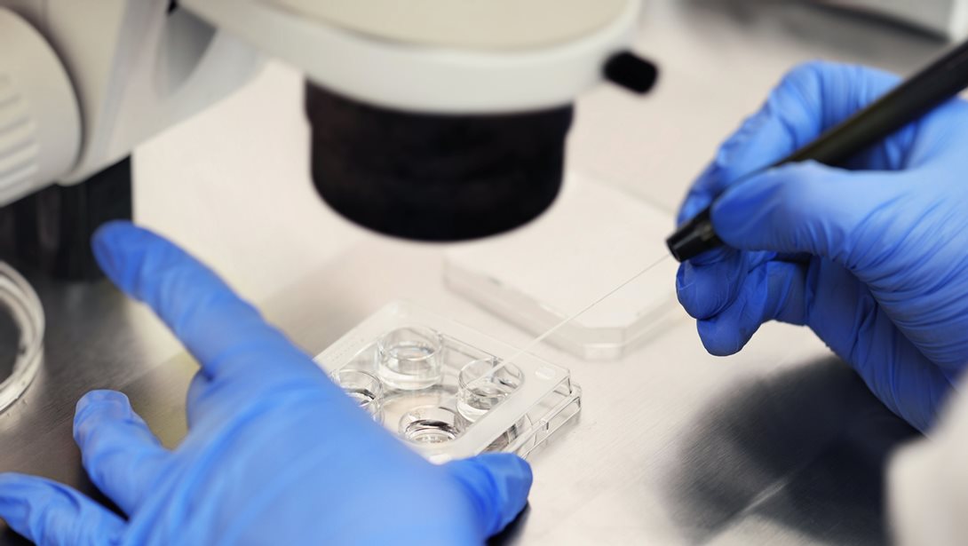 18 παιδιά έχουν γεννηθεί στην Ελλάδα από το σπέρμα δότη με καρκινογόνο γονίδιο