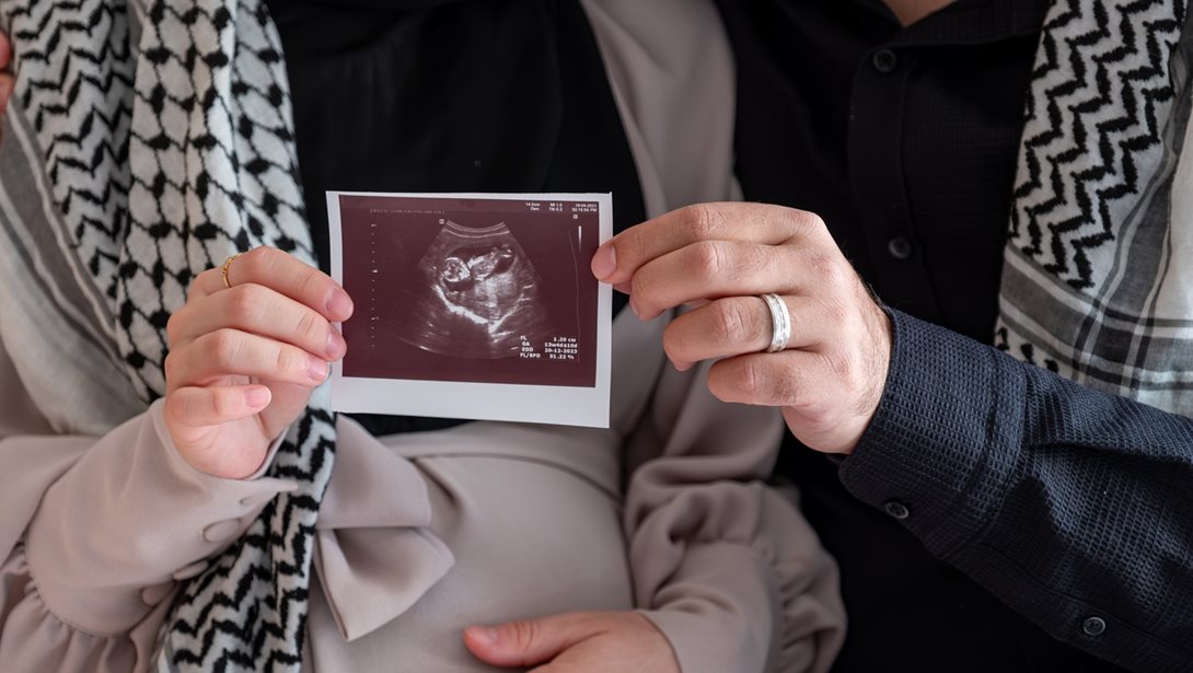 Ο υποσιτισμός εγκύων και βρεφών στη Γάζα θα αφήσει πληγές που θα διαρκέσουν "για γενιές"