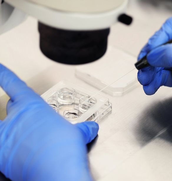 18 παιδιά έχουν γεννηθεί στην Ελλάδα από το σπέρμα δότη με καρκινογόνο γονίδιο