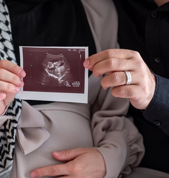 Ο υποσιτισμός εγκύων και βρεφών στη Γάζα θα αφήσει πληγές που θα διαρκέσουν "για γενιές"