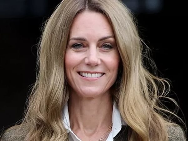 Όταν η περούκα της Kate έδειξε τη γυμνή αλήθεια μιας κοινωνίας