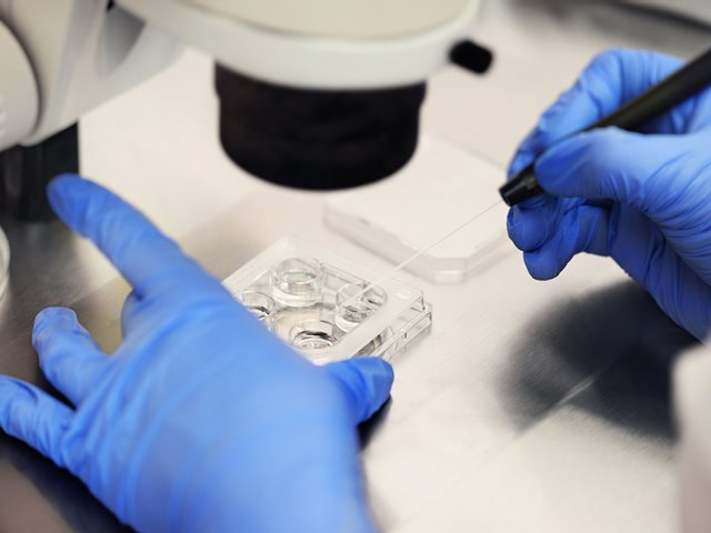 18 παιδιά έχουν γεννηθεί στην Ελλάδα από το σπέρμα δότη με καρκινογόνο γονίδιο