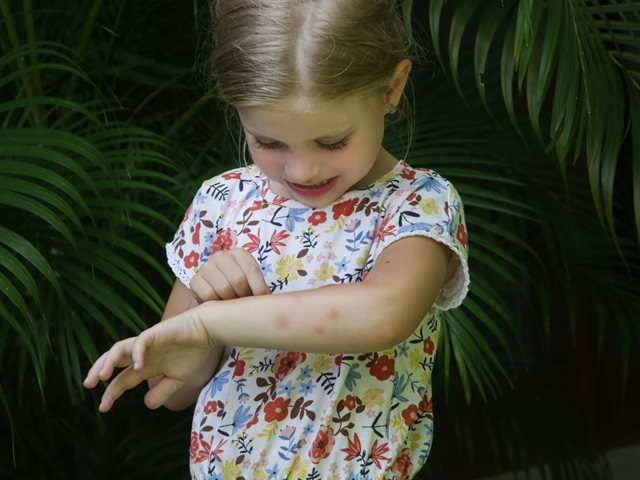 Πώς θα προστατεύσουμε τα παιδιά από τα κουνούπια και τον ιό του Δυτικού Νείλου