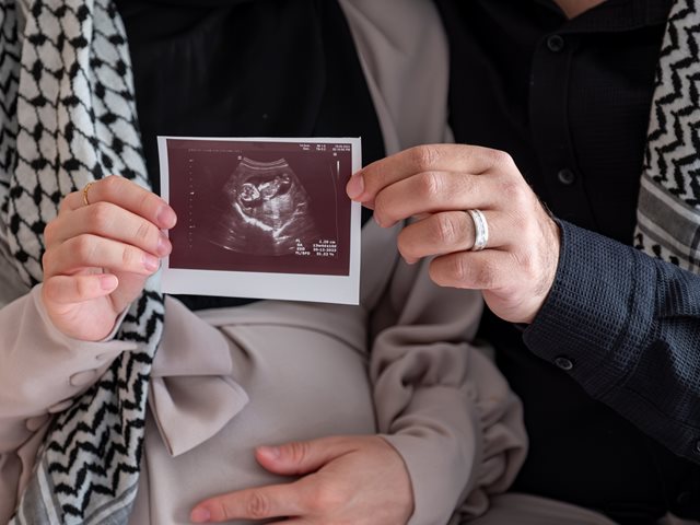 Ο υποσιτισμός εγκύων και βρεφών στη Γάζα θα αφήσει πληγές που θα διαρκέσουν "για γενιές"